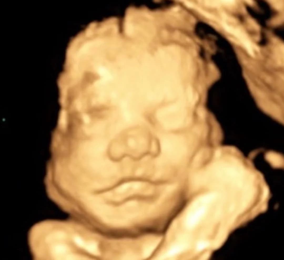 3D ultrasound session at 26 weeks pregnancy — Baby Studio 4D, Raleigh NC