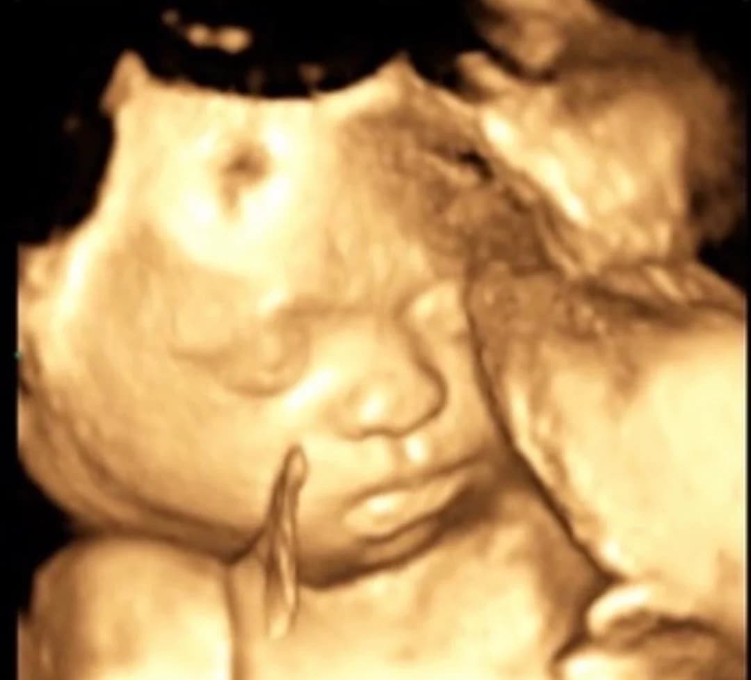 3D ultrasound session at 32 weeks pregnancy — Baby Studio 4D, Raleigh NC