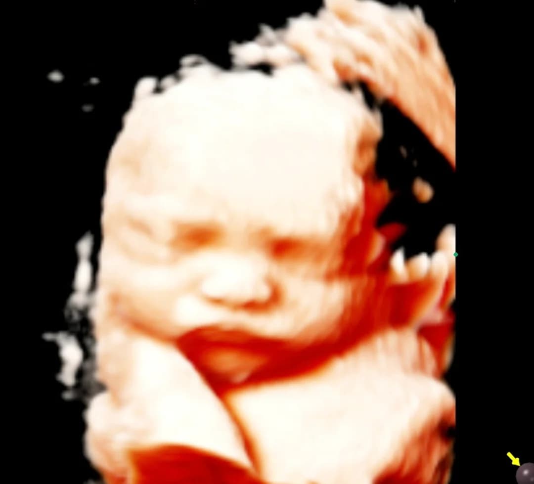 HD ultrasound session at 28 weeks pregnancy — Baby Studio 4D, Raleigh NC