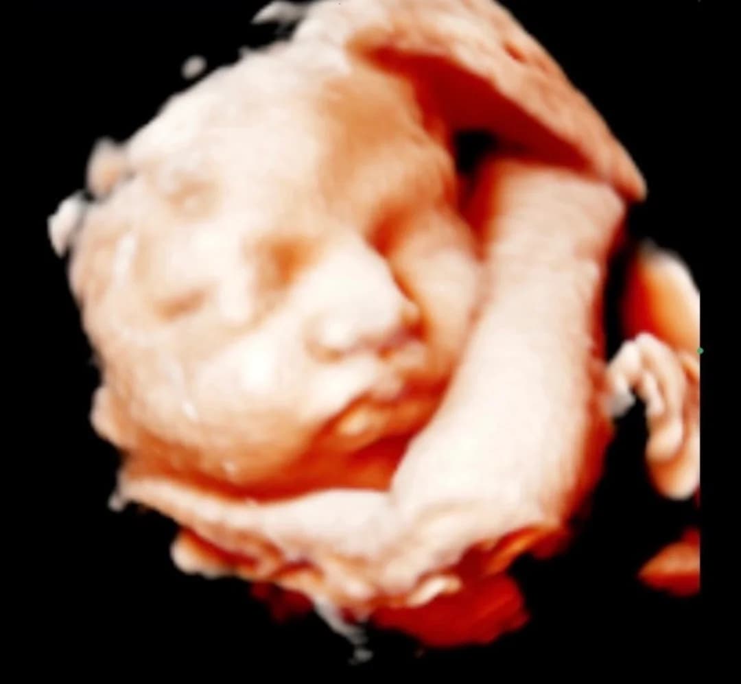 HD ultrasound session at 35 weeks pregnancy — Baby Studio 4D, Raleigh NC